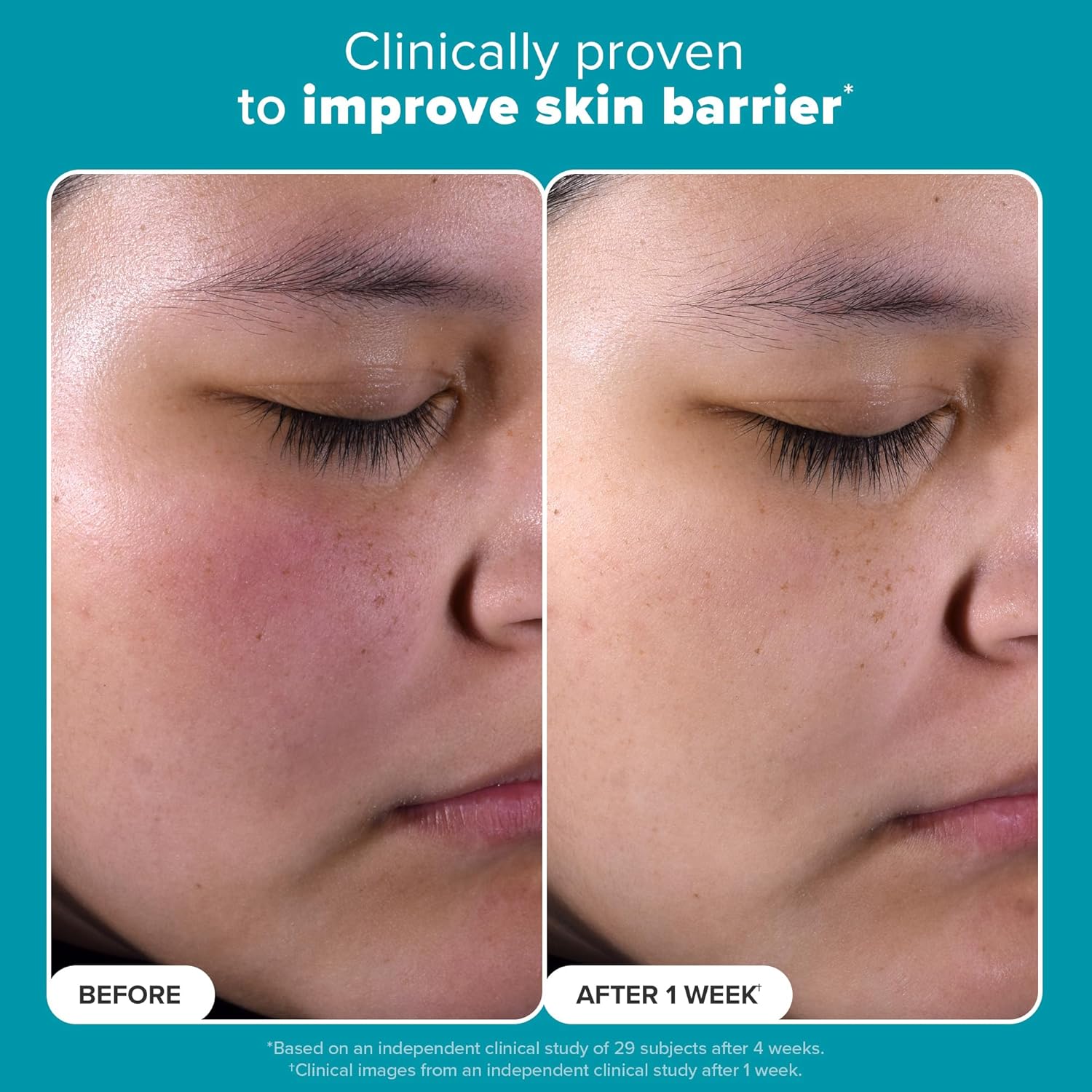 Paula's Choice SKIN PERFECTING 2% BHA Liquid Salicylic Acid Exfoliant-Facial Exfoliant for Blackheads, Enlarged Pores, Wrinkles & Fine Lines 24hrsmart